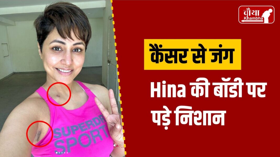 Hina Khan Breast Cancer