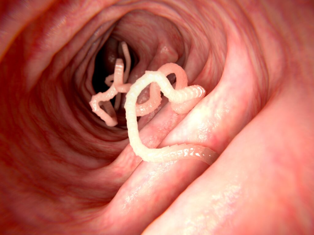 Undercooked Pork Tapeworm