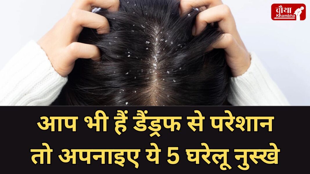 Home remedies for dandruff