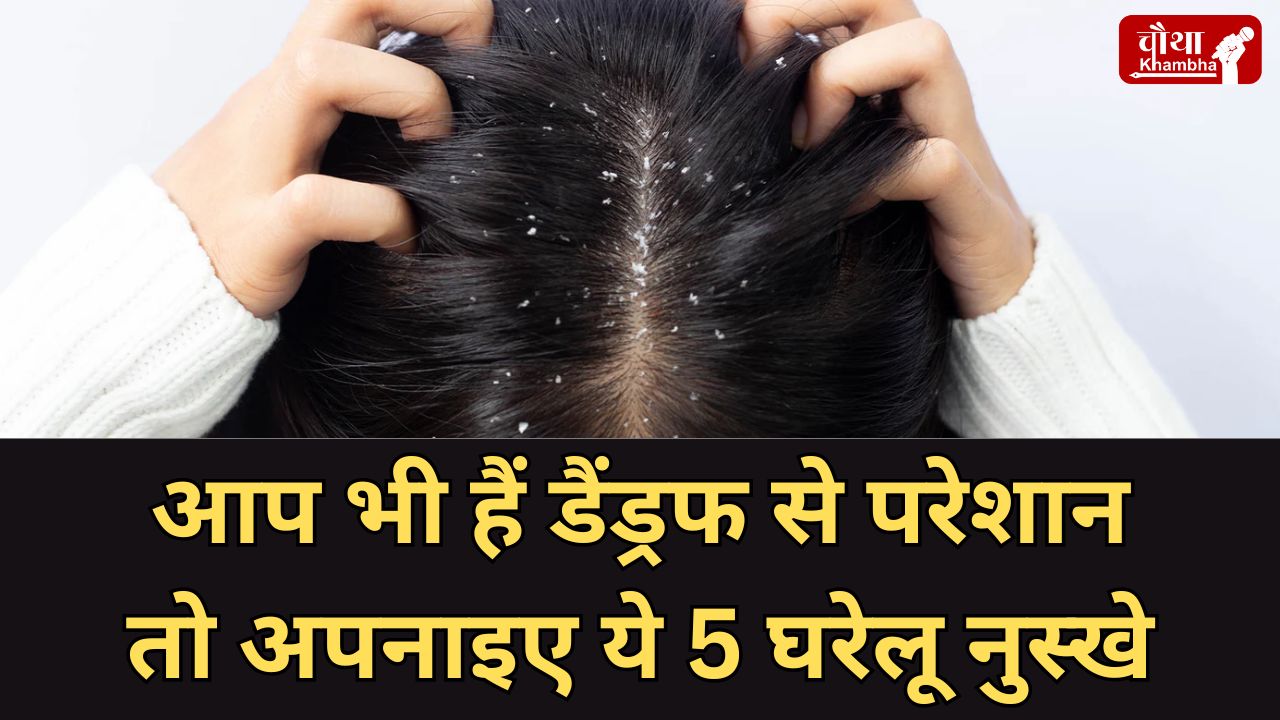 Home remedies for dandruff
