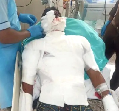 Grenade explosion, Grenade, what is Grenade, Grenade explosion Bhopal, Bhopal Mock Drill, jawan Injured, Bhopal News, MP News,