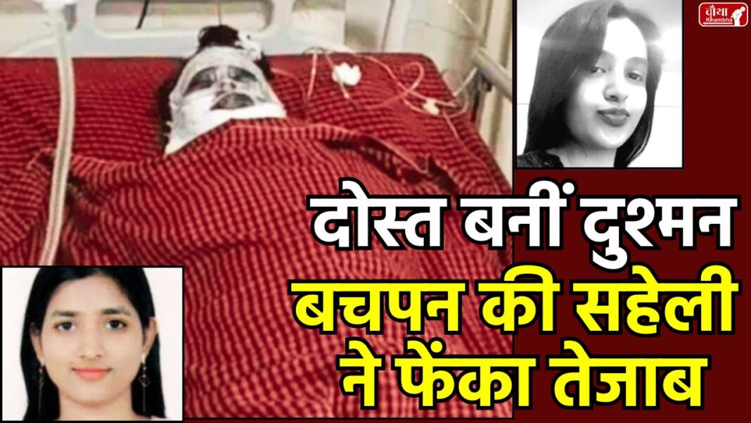 Childhood Friend Acid Attack Jabalpur acid attack, acid attack case, Childhood Friend, Friend threw acid, Shraddha Das Acid Attack, Ishita Sahu Arrested, Women Violence News, Jabalpur News, Jabalpur Crime News, MP News, Acid Attack