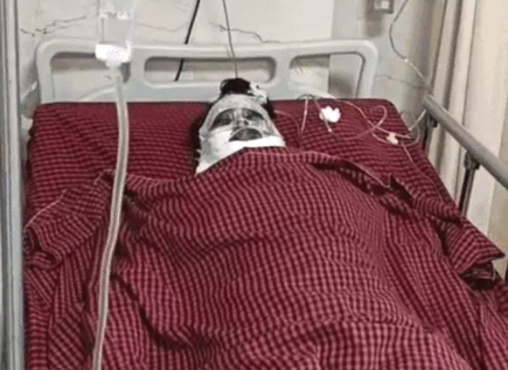 Jabalpur acid attack, acid attack case, Childhood Friend, Friend threw acid, Shraddha Das Acid Attack, Ishita Sahu Arrested, Women Violence News, Jabalpur News, Jabalpur Crime News, MP News, Acid Attack