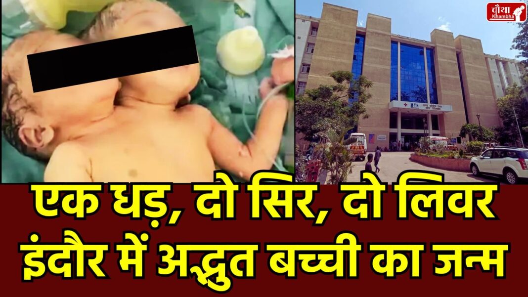 Child With Two Heads Two-headed baby girl, Indore, Rare baby girl born, two livers one heart, MTH Hospital Indore Rare case, Medical Science, Twins, Madhya Pradesh News, MTH Hospital, Parapagus Dicephalus Twins, MP News, Local News