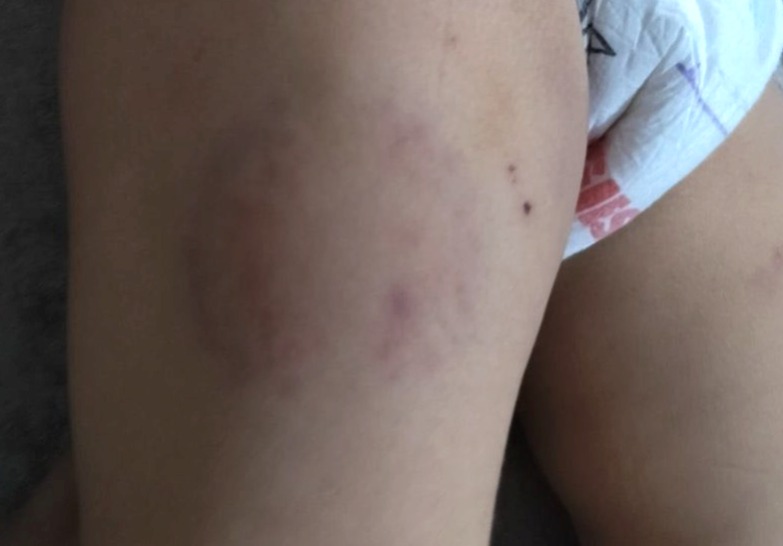 Noida day care incident, torture of 15 month old girl, day care CCTV video, Noida child abuse case, cruelty with girl in day care, entire incident captured in CCTV, Noida day care video, Noida day care CCTV, girl slapped,