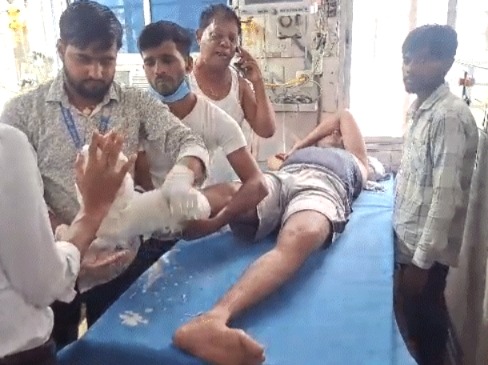 Car ran over policeman leg, policemen injured, Tejashwi Yadav, Tejashwi car, collision with Tejashwi Yadav's car, Car ran over policeman leg, policeman's leg broken, Bihar, Voter Rights Yatra, Voter Rights Yatra accident,