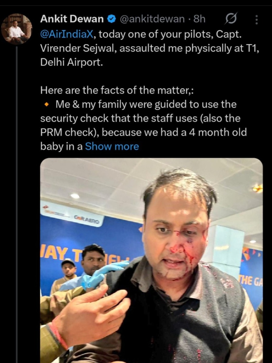 Delhi Airport assault, pilot beats passenger, Air India Express pilot suspended, Captain Virender Sejwal, passenger Ankit Diwan, Delhi Airport violence, DGCA investigation, airport security, pilot assault case, Delhi Airport Terminal 1, passenger rights, airline violence
