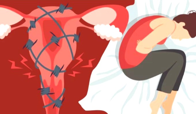 Period Leave Policy, Period Leave, Supreme Court, Paid Menstrual Leave, CJI Surya Kant, Supreme Court on Period Leave, Women Employment Rights, मेंस्ट्रुअल लीव सुप्रीम कोर्ट, What is Period Leave, Paid Period Leave